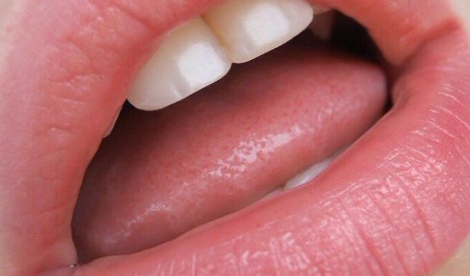 leicht geöffnete Mundfotze